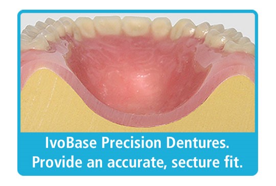 Vertex Thermosens Dentures Worcester MA 1605